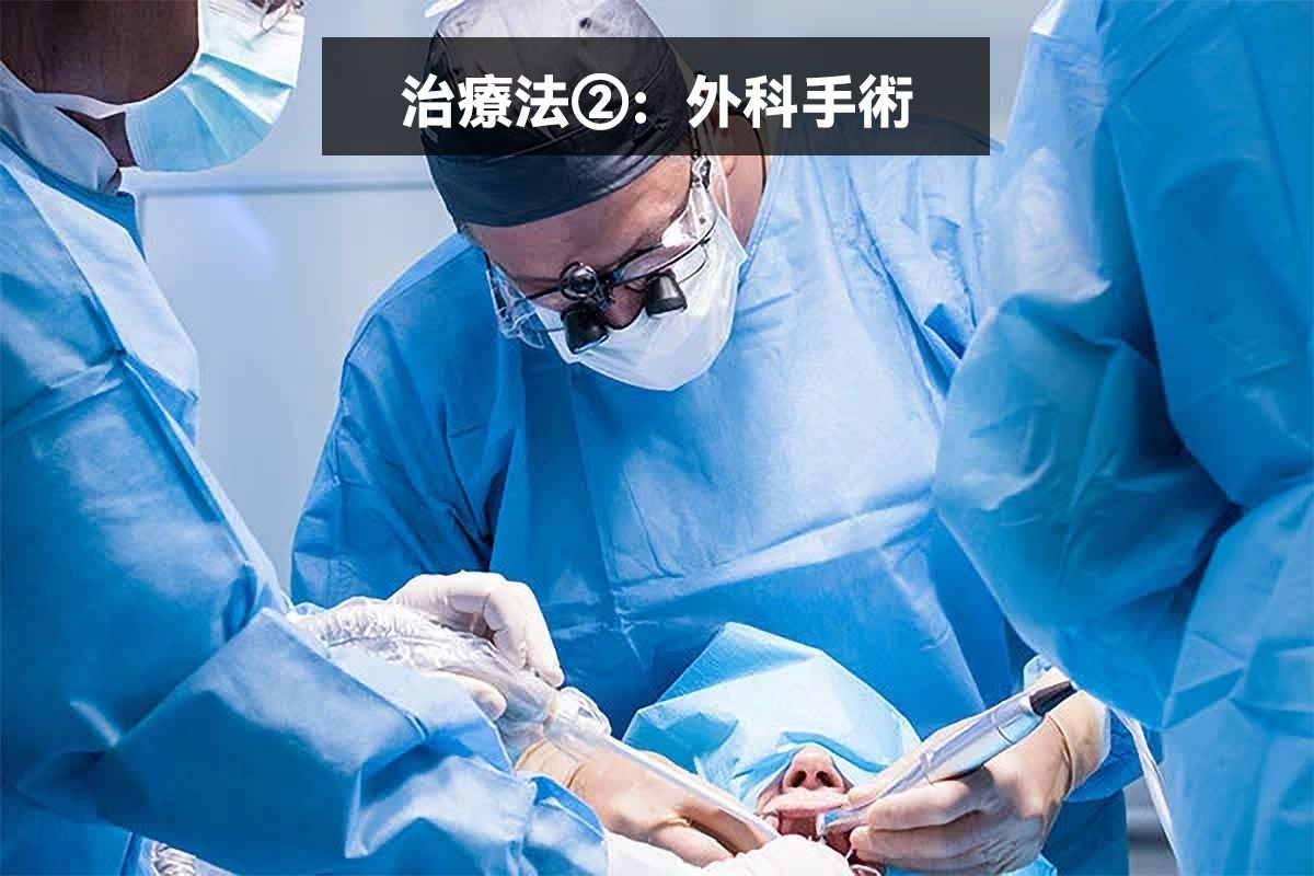 治療法②：外科手術